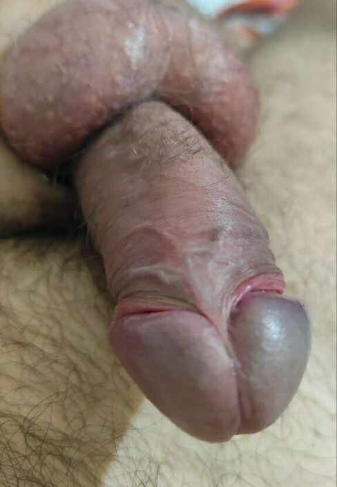 Яйца и головка