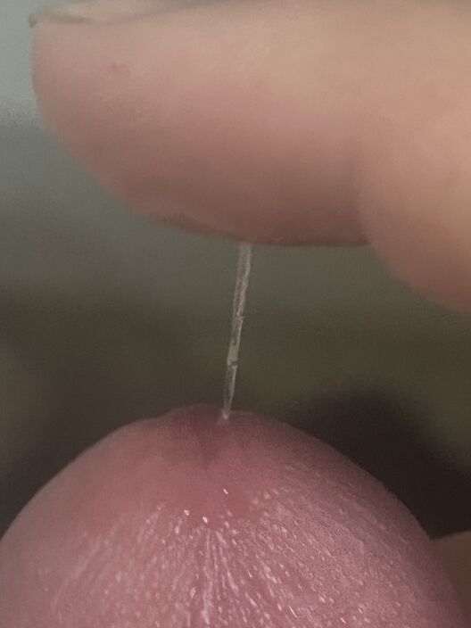 …………