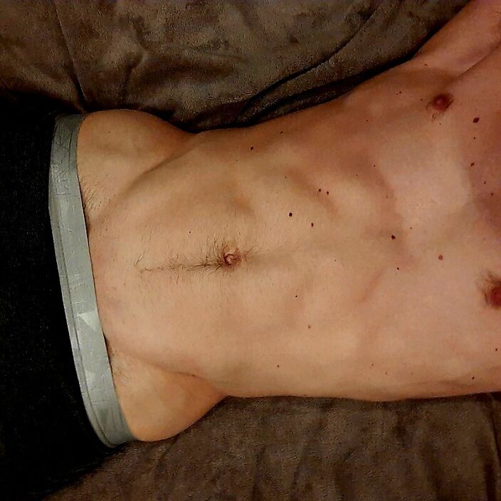 Аоа