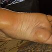 Penis
