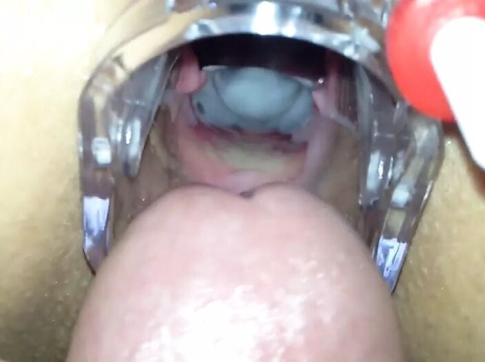 Speculum In Pussy
