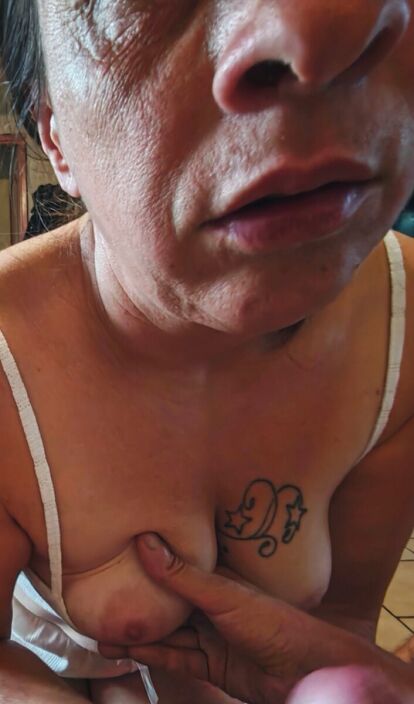 Areola