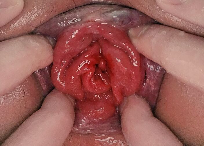 anal