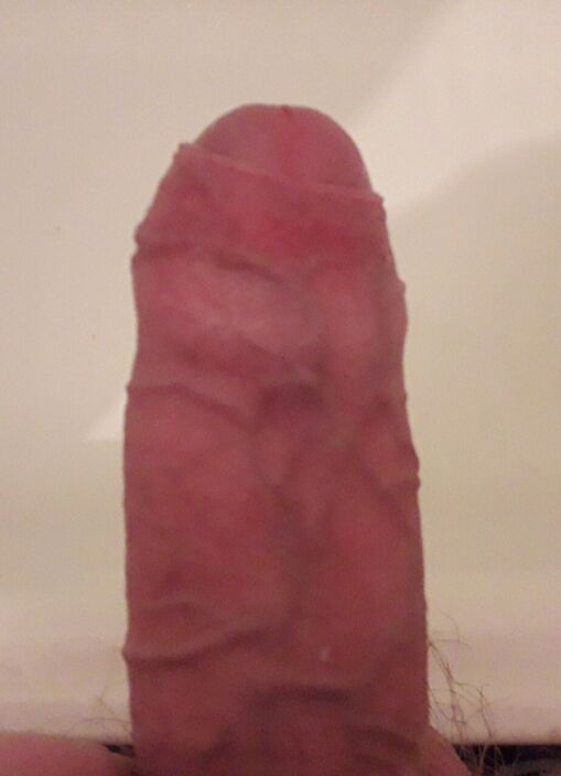 Мой апарат)