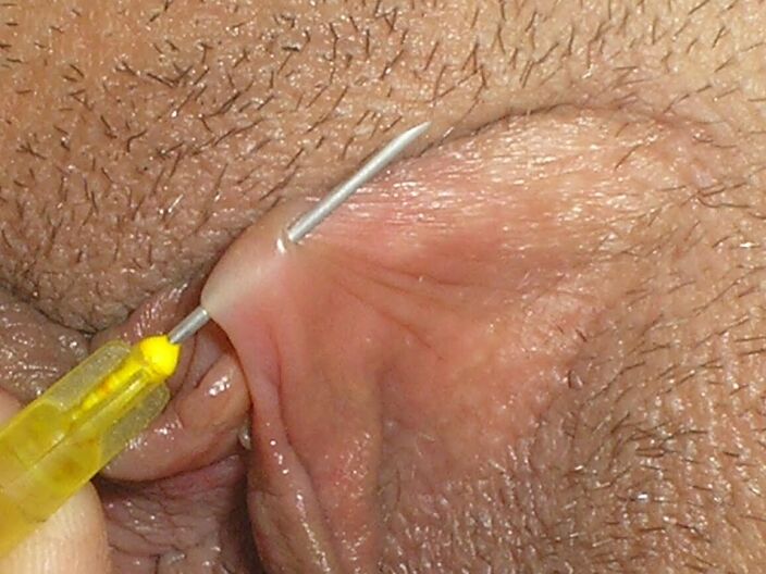 Венгерская мазашлюха