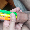 Object in my foreskin