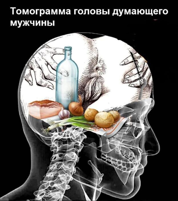 мозг