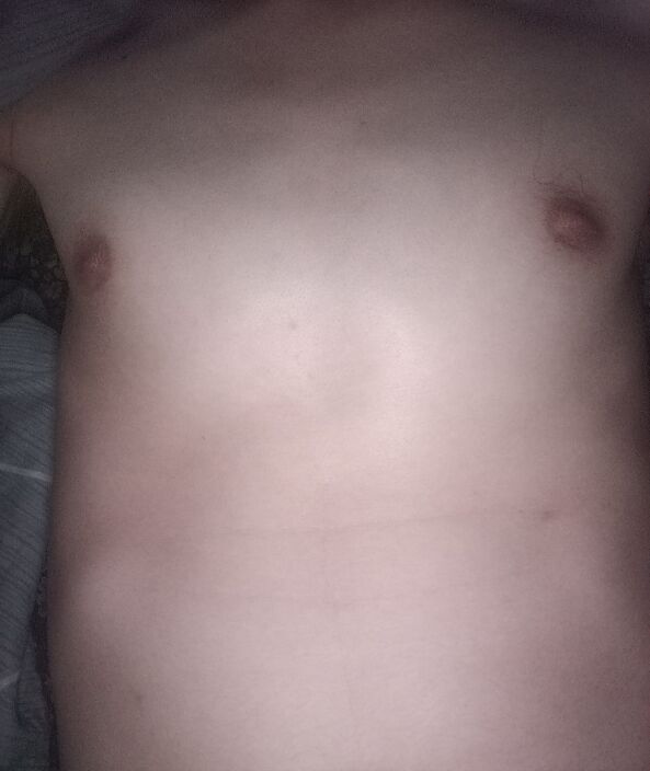 Torso