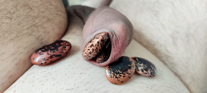 My foreskin fun with bean