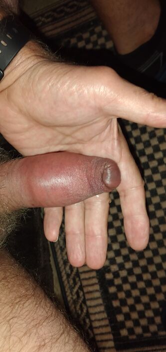 После пумпе