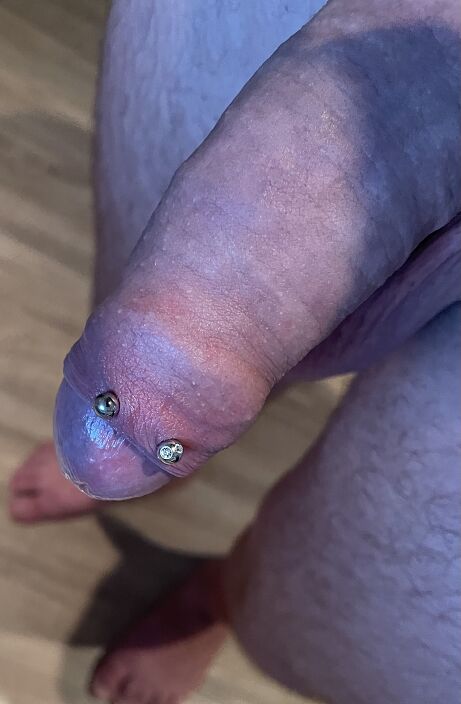 ????????????????????????