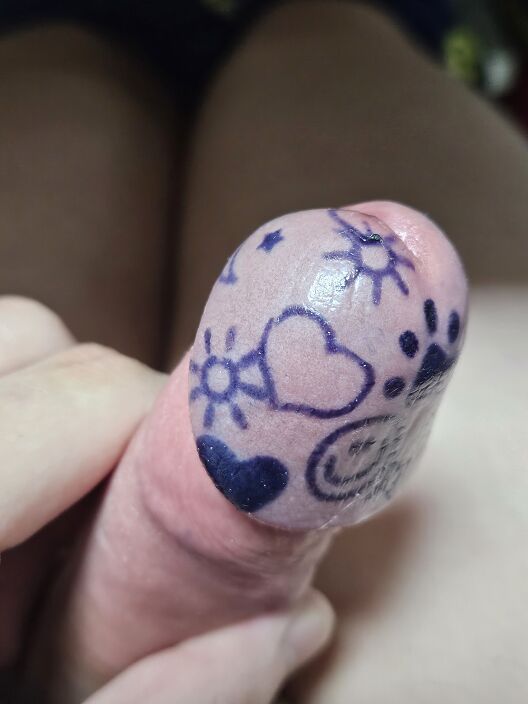 glans penis