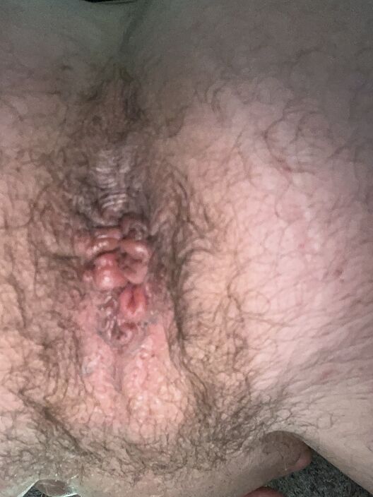 Хочу в жопу