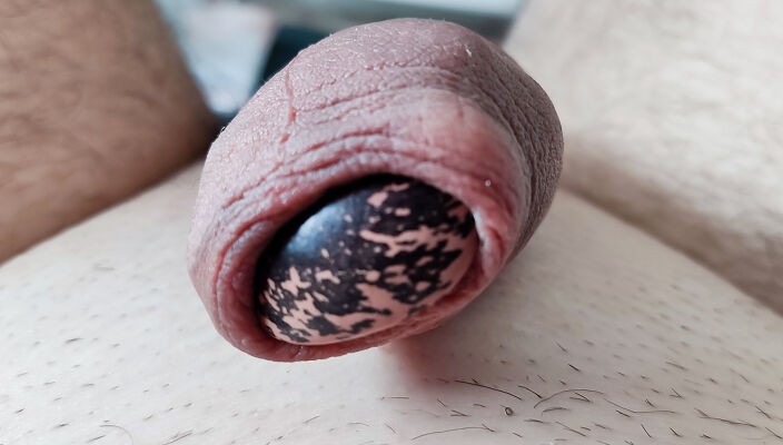 My foreskin fun with bean