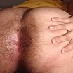 Asshole
