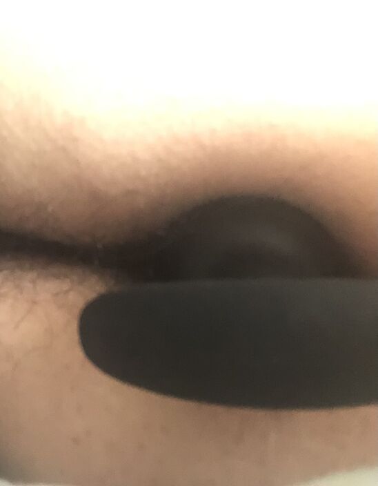 Живой лучше)