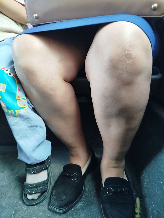 Fart