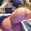 пенис