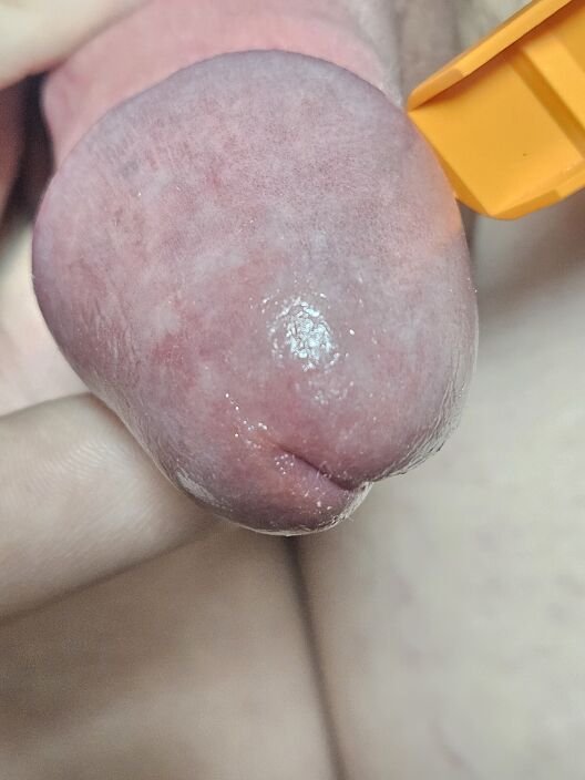 glans close up