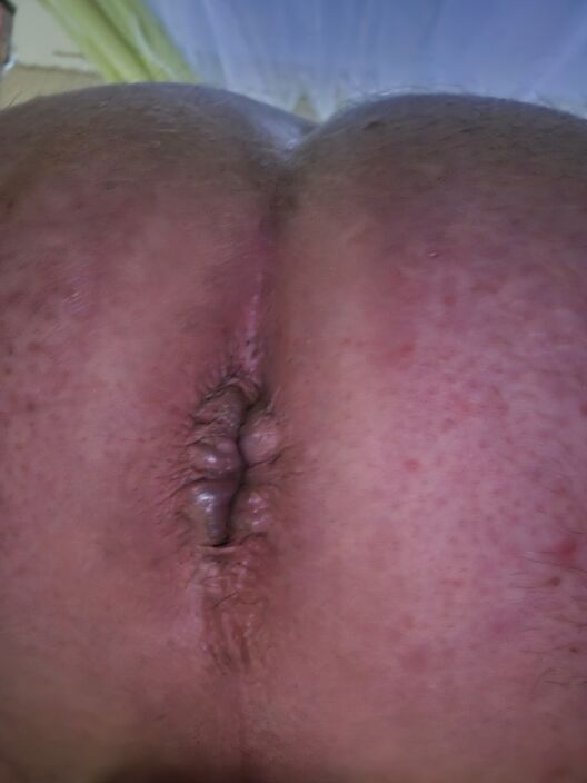 Анал разработан