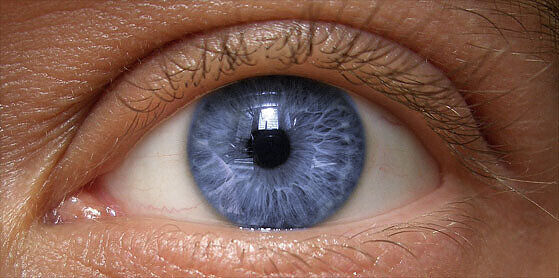 Eye