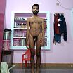 Total body