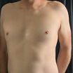 body