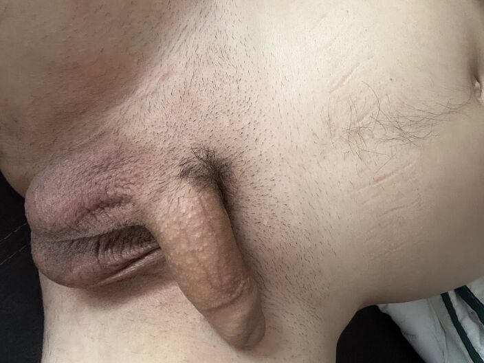mmm