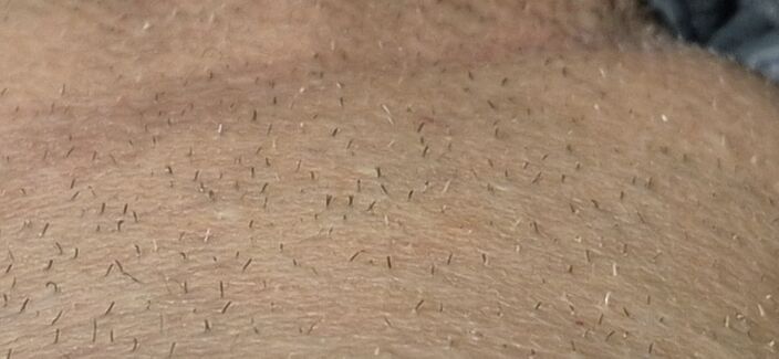 Это на лобке