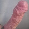 Dick