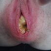 Pussy insertion