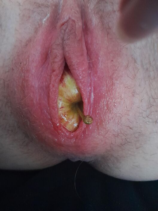 Pussy insertion