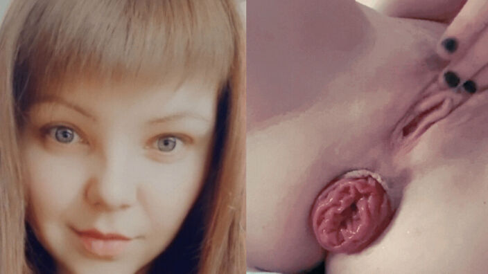 Juicypussy2288's face and her anal prolapse from masturb