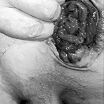 anal