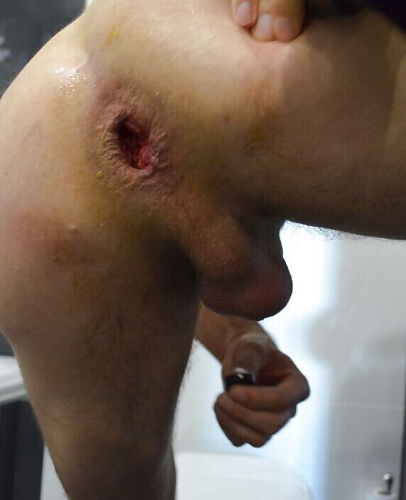 уничтоженная жопа:(