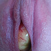 Pussy insertion