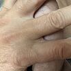 Six fingers)))
