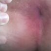 Me Anus 2025