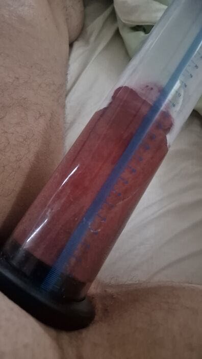 3 подход помпа 2 часа