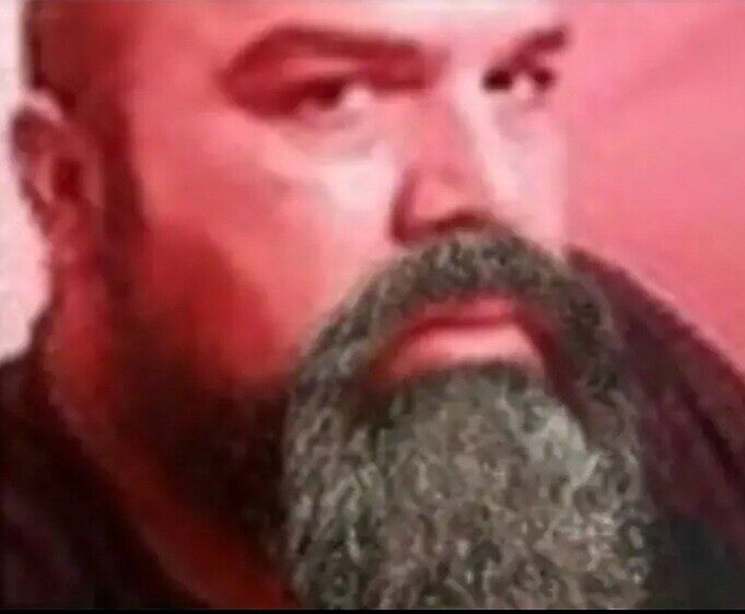 Я. Волосы на голове есть