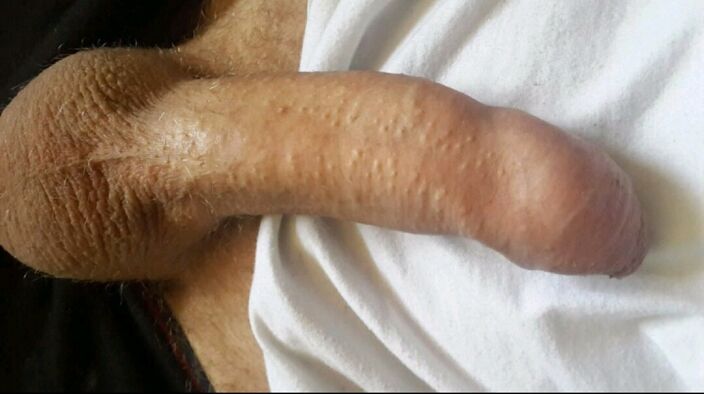 Xxx
