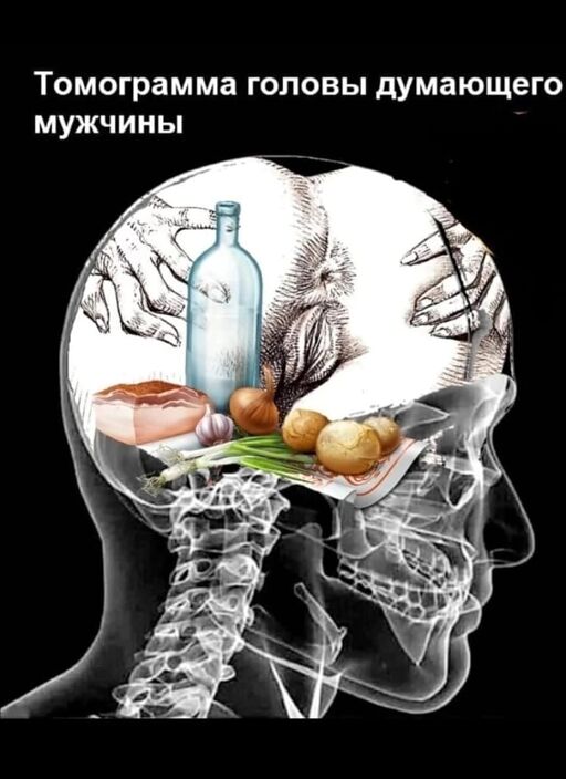 Моё МРТ головы