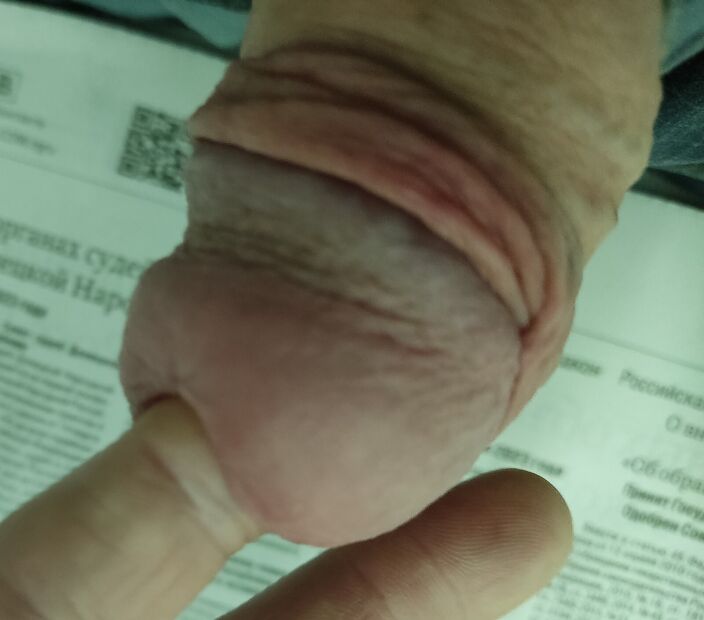 Палец в уретре