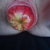 Pussy insertion