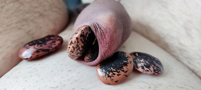 My foreskin fun with bean