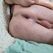 Дырка после ебли дило