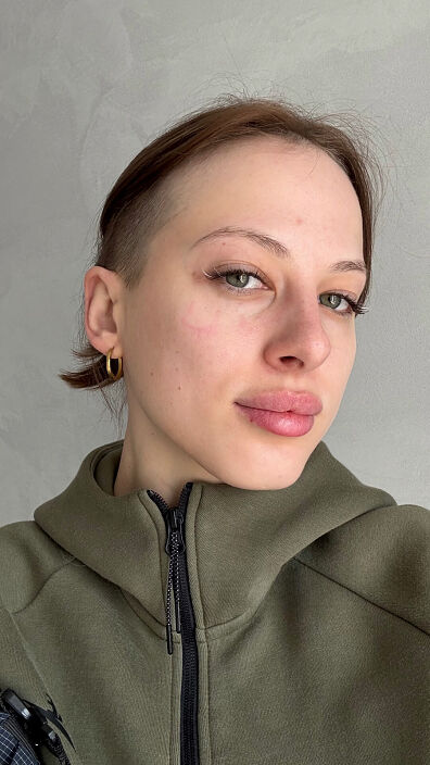 лучики в глазках