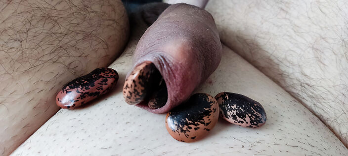 My foreskin fun with bean