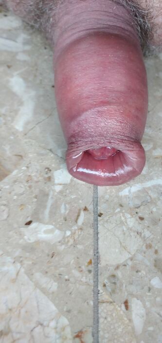 После пумпе