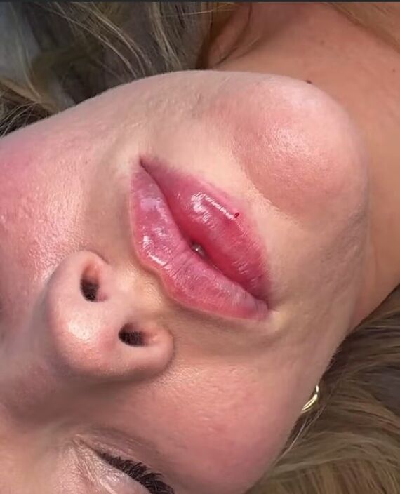 чего то не хватает на губах